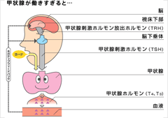 は と 原発 性