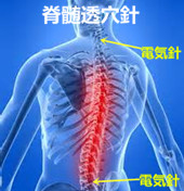 腰髄損傷の原因｜腰髄損傷【神経疾患】