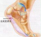 足底筋膜炎の原因｜足底筋膜炎