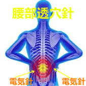 腰痛の原因｜腰痛【整形外科疾患】